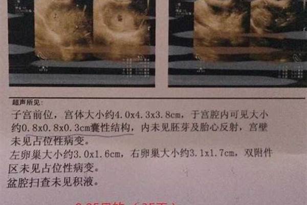 流产后量越来越少怎么办